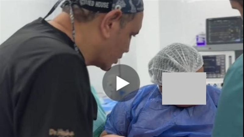 نقابة الأطباء : التحقيق مع طبيب أجرى عملية تكميم معدة لطفلة